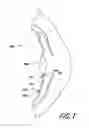 Fig. 02 - BIASED ACCOMMODATING INTRAOCULAR LENS