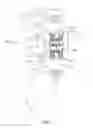 Fig. 07 - Vertebral body replacement device and method for use to maintain a space between two vertebral bodies within a spine