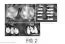 Fig. 04 - Methods for increasing cotton fiber length