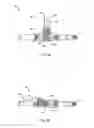 Fig. 03 - Fluid extractor device and kit