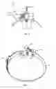 Fig. 04 - Fluid extractor device and kit