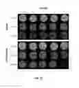Fig. 31 - Polymeric nanocarriers with linear dual response mechanism
