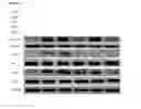 Fig. 08 - Protein inhibitors to complement and VEGF pathways and methods of use thereof