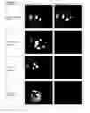 Fig. 09 - Protein inhibitors to complement and VEGF pathways and methods of use thereof