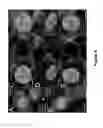 Fig. 10 - REGENERATION OF INNER EAR CELLS
