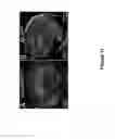 Fig. 14 - REGENERATION OF INNER EAR CELLS