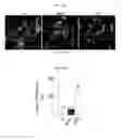 Fig. 22 - Use of an anti-Ang2 antibody