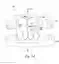 Fig. 09 - Digital dental modeling