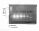 Fig. 06 - METHOD FOR DETECTING NUCLEIC ACIDS BY SIMULTANEOUS ISOTHERMAL AMPLIFICATION OF NUCLEIC ACIDS AND SIGNAL PROBE