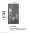 Fig. 11 - METHOD FOR DETECTING NUCLEIC ACIDS BY SIMULTANEOUS ISOTHERMAL AMPLIFICATION OF NUCLEIC ACIDS AND SIGNAL PROBE