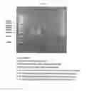 Fig. 12 - METHOD FOR DETECTING NUCLEIC ACIDS BY SIMULTANEOUS ISOTHERMAL AMPLIFICATION OF NUCLEIC ACIDS AND SIGNAL PROBE