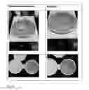 Fig. 04 - Cosmetic product comprising screen mesh and method for producing same