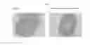 Fig. 07 - Methods and compositions for treating arteriosclerotic vascular diseases