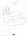 Fig. 02 - Sub-urethral sling delivery device