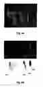 Fig. 06 - Atherosclerotic plaque detection