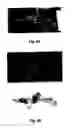 Fig. 07 - Atherosclerotic plaque detection