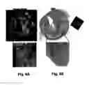 Fig. 09 - Atherosclerotic plaque detection