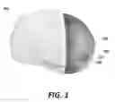 Fig. 02 - Patient specific bone preparation for consistent effective fixation feature engagement