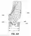 Fig. 05 - Patient specific bone preparation for consistent effective fixation feature engagement