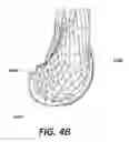 Fig. 06 - Patient specific bone preparation for consistent effective fixation feature engagement