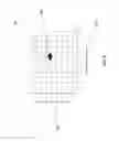 Fig. 04 - Device for automatic mapping of complex fractionated atrial electrogram