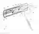 Fig. 01 - Aspiration thrombectomy catheter system, and associated methods