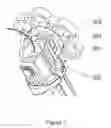 Fig. 04 - Surgical instrument and method for tensioning and securing a flexible suture