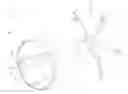 Fig. 01 - Medical devices and systems for manipulating foreign bodies and methods of using the same