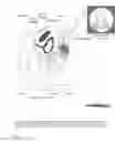 Fig. 02 - CUTTING DEVICE, HYSTERECTOMY ASSEMBLY FOR LAPAROSCOPIC HYSTERECTOMY