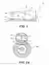 Fig. 02 - Endoluminal fundoplication device and related method