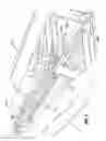 Fig. 06 - Apparatus for applying surgical clips