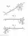 Fig. 02 - Surgical fasteners for securing prosthetic devices to tissue