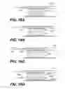 Fig. 22 - Endovascular devices and methods for exploiting intramural space