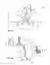Fig. 02 - Minimally invasive lung volume reduction devices, methods, and systems