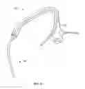 Fig. 06 - Minimally invasive lung volume reduction devices, methods, and systems
