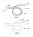 Fig. 35 - Minimally invasive lung volume reduction devices, methods, and systems