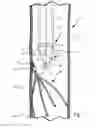 Fig. 02 - Vascular implant retrieval assembly and method