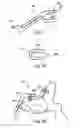 Fig. 06 - Laminoplasty fixation devices