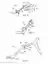 Fig. 07 - Laminoplasty fixation devices