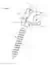 Fig. 03 - Osseous anchoring implant with a polyaxial head and method for installing the implant