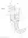 Fig. 05 - Osseous anchoring implant with a polyaxial head and method for installing the implant