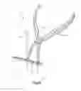 Fig. 02 - Bone fixation system including K-wire compression