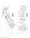 Fig. 08 - Bone fixation system including K-wire compression