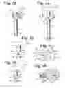 Fig. 06 - TOOL SYSTEM FOR DYNAMIC SPINAL IMPLANTS