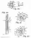 Fig. 10 - TOOL SYSTEM FOR DYNAMIC SPINAL IMPLANTS