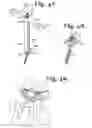 Fig. 14 - TOOL SYSTEM FOR DYNAMIC SPINAL IMPLANTS