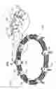 Fig. 02 - Implant and anchor placement