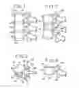Fig. 02 - Spinal tissue distraction devices