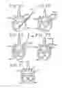 Fig. 22 - Spinal tissue distraction devices