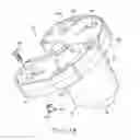 Fig. 02 - Stabilizing prosthesis support structure